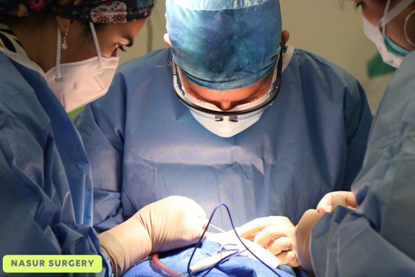 Nasur surgery